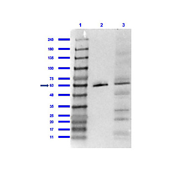 Anti-PPAR gamma 1 and 2 (internal) (RABBIT) Antibody, 100µg, Liquid (sterile filtered)