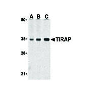 TIRAP Antibody cterm 100µg