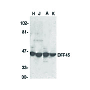 DFF45 Antibody cterm 100µg