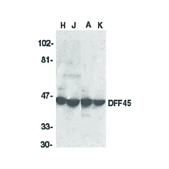 DFF45 Antibody cterm 100µg