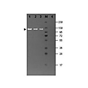Anti-BETA GALACTOSIDASE (E.coli) (RABBIT) Antibody, 25µL, Liquid (sterile filtered)