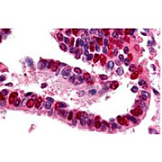 Anti-Ubiquitin Activating Enzyme E1 (RABBIT) Antibody, 500µg, Lyophilized