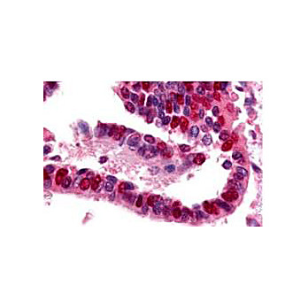 Anti-Ubiquitin Activating Enzyme E1 (RABBIT) Antibody, 500µg, Lyophilized