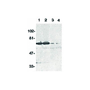 Anti-DR6 (RABBIT) Antibody, 100µg, Liquid (sterile filtered)