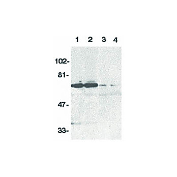 Anti-DR6 (RABBIT) Antibody, 100µg, Liquid (sterile filtered)