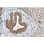 Anti-F-Box Protein Fbp5A (Rabbit) Antibody, 100µg, Liquid (sterile filtered)