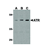 ATR internal Antibody 100µg