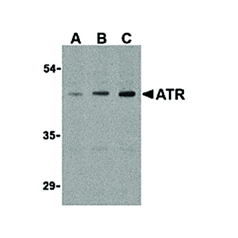 ATR internal Antibody 100µg