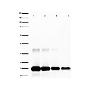 Anti-Human IL-2 (RABBIT) Antibody Peroxidase Conjugated, 100µg, Lyophilized