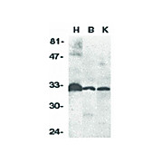 Anti-DcR3 (RABBIT) Antibody, 100µg, Liquid (sterile filtered)