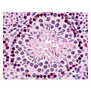Anti-Gli2 (RABBIT) Antibody, 100µg, Liquid (sterile filtered)