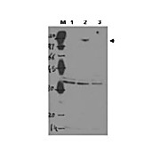 Anti-ASPP2 (RABBIT) Antibody, 100µg, Liquid (sterile filtered)