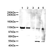 Anti-Human ELG-1 (RABBIT) Antibody, 100µg, Liquid (sterile filtered)
