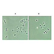 Anti-NFKB p65 NLS specific (RABBIT) Antibody, 100µg, Liquid (sterile filtered)
