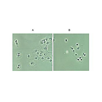 Anti-NFKB p65 NLS specific (RABBIT) Antibody, 100µg, Liquid (sterile filtered)