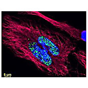 Anti-FLUORESCEIN (GOAT) Antibody DyLight™ 488 Conjugated, 100µg, Lyophilized