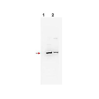 Anti-ßTrCP2 (RABBIT) Antibody, 100µg, Liquid (sterile filtered)