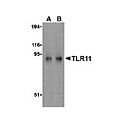 TLR11 Antibody cterm 100µg