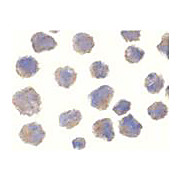 Anti-Beta-site APP-Cleaving Enzyme (BACE/Asp2) (RABBIT) Antibody, 100µg, Liquid (sterile filtered)