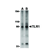 Anti-TLR1 (RABBIT) Antibody, 100µg, Liquid (sterile filtered)