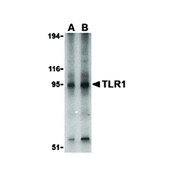 Anti-TLR1 (RABBIT) Antibody, 100µg, Liquid (sterile filtered)