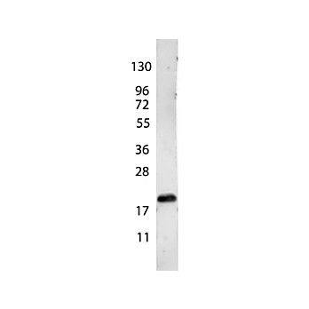 Anti-VEGF-165 (RABBIT) Antibody, 100µg, Lyophilized