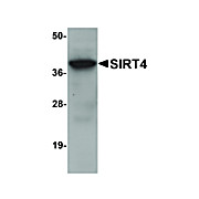 Anti-SIRT4 (CHICKEN) Antibody, 100µg, Liquid (sterile filtered)