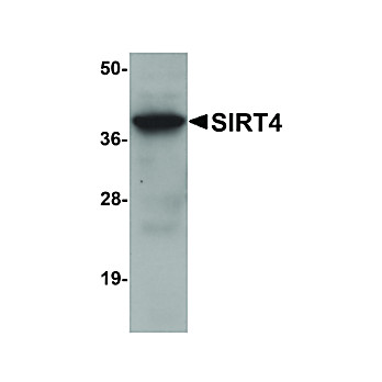 Anti-SIRT4 (CHICKEN) Antibody, 100µg, Liquid (sterile filtered)