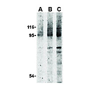 NOD2 Antibody nterm 100µg