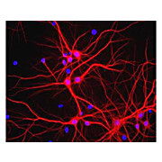 Anti-Microtubule Associated Protein 2 (MAP2) (Chicken) Antibody, 100µL, Liquid