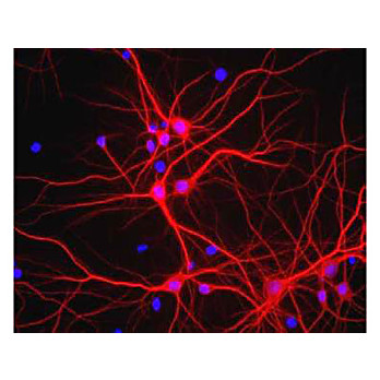 Anti-Microtubule Associated Protein 2 (MAP2) (Chicken) Antibody, 100µL, Liquid