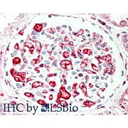 Anti-APOLIPOPROTEIN C-II (GOAT) Antibody, 1mg, Liquid (sterile filtered)