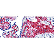 Anti-Collagen Type VI (RABBIT) Antibody, 500µg, Liquid (sterile filtered)