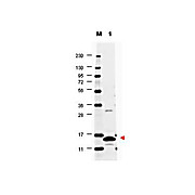 Anti-GM-CSF (RABBIT) Antibody, 100µg, Lyophilized