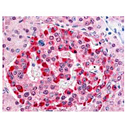 Anti-Human PARK-7 (RABBIT) Antibody, 100µg, Liquid (sterile filtered)
