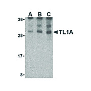 TL1A Antibody 100µg