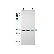 Anti-GSK3 alpha pS21 (RABBIT) Antibody, 100µg, Liquid (sterile filtered)