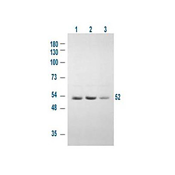 Anti-GSK3 alpha pS21 (RABBIT) Antibody, 100µg, Liquid (sterile filtered)