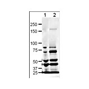 Anti-SLIT-1 (RABBIT) Antibody, 100µg, Liquid (sterile filtered)