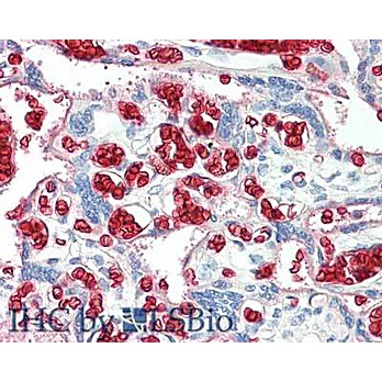 Anti-HUMAN Red Blood Cell (RBC) (RABBIT) Antibody, 50mg, Lyophilized