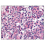 Anti-Polo-like Kinase (Plk1) pT210 (RABBIT) Antibody, 100µg, Liquid (sterile filtered)