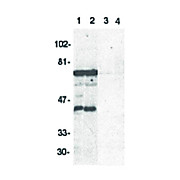 Anti-DRAK2 (RABBIT) Antibody, 100µg, Liquid (sterile filtered)