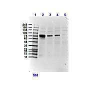Anti-NEK2 (RABBIT) Antibody, 100µg, Liquid (sterile filtered)