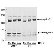 Anti-AKT2 (RABBIT) Antibody, 100µg, Liquid (sterile filtered)