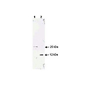 Anti-TGF beta 1 (RABBIT) Antibody, 100µg, Liquid (sterile filtered)