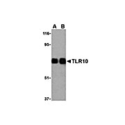 Anti-TLR10 (RABBIT) Antibody, 100µg, Liquid (sterile filtered)