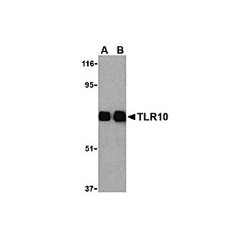 Anti-TLR10 (RABBIT) Antibody, 100µg, Liquid (sterile filtered)