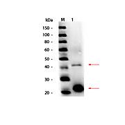 Anti-ACID PHOSPHATASE (Potato) (RABBIT) Antibody Peroxidase Conjugated, 25µL, Liquid (sterile filtered)
