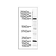 Anti-LIM Kinase (RABBIT) Antibody, 100µg, Liquid (sterile filtered)