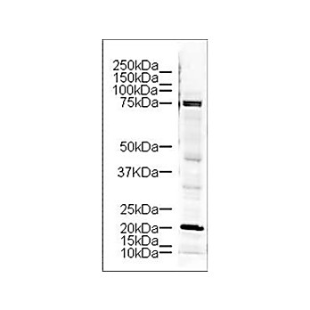 Anti-LIM Kinase (RABBIT) Antibody, 100µg, Liquid (sterile filtered)